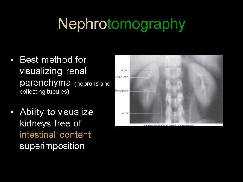 Nephrotomography Best method for visualizing renal parenchyma (neprons and collecting tubules)  Ability to